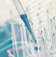 体外诊断试剂生物活性原料（自身免疫性疾病）