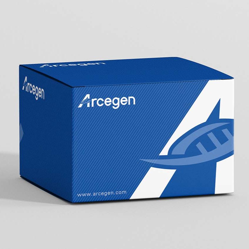 快速gDNA消化与反转一步法预混液(用于qPCR)