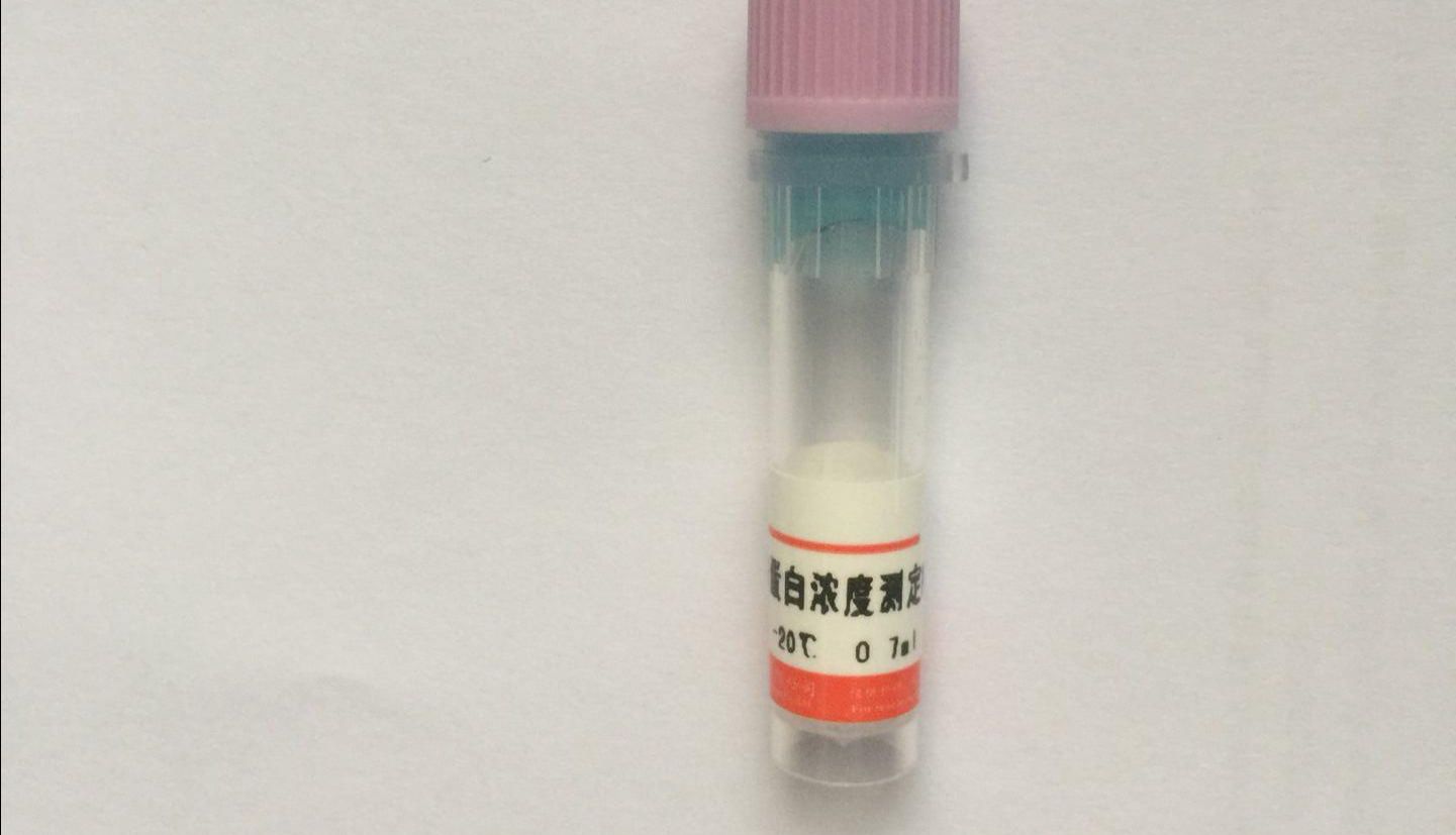 RNA提取步骤+去除DNA污染方法