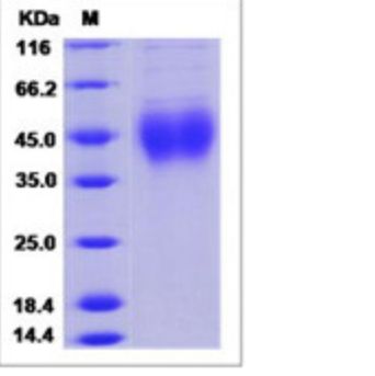 Recombinant Human TMIGD1 Protein (ECD, His Tag)