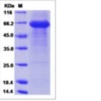 Recombinant Human Tomoregulin-1 Protein (ECD, hFc Tag)