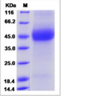 Recombinant Rat DNAM-1/CD226 Protein (ECD, His Tag)