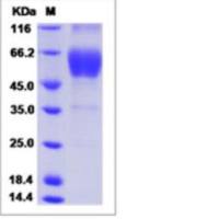 Recombinant Human Calcitonin receptor Protein (ECD, hFc Tag)