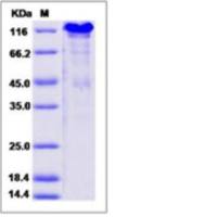 Recombinant Mouse SPARCL1 Protein (His Tag), HPLC-verified