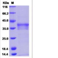 Recombinant Human OAF Protein (His Tag)