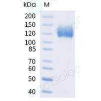 Recombinant Human IL-31RA Protein (ECD, hFc Tag), HPLC-verified