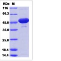 Recombinant Rat Enolase 1/ENO1 Protein (His Tag)