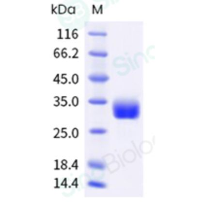 Recombinant Human Angiopoietin-2/ANGPT2 Protein (His Tag)