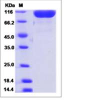 Recombinant Mouse DPP-4/CD26/DPPIV Protein (His Tag)