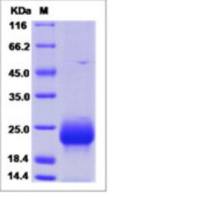 Recombinant Human FSH Beta Protein (His Tag)