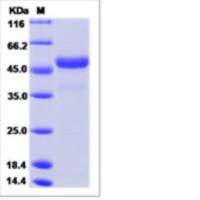 Recombinant Rat Reticulocalbin 3/RCN3 Protein (His Tag)