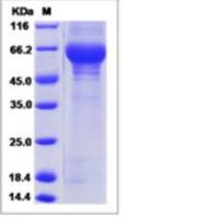 Recombinant Human LCAT Protein (His Tag)