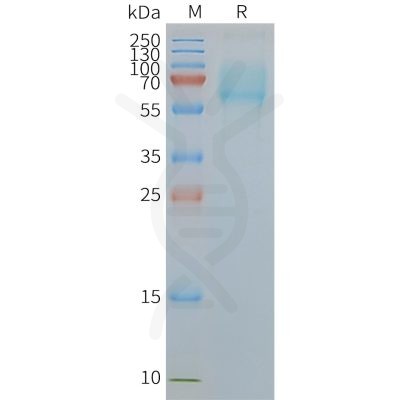 page-FLP100057 SLC1A5 Fig.2 SDS PAGE 1