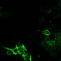 猪圆环病毒PCV2-CAP蛋白单抗