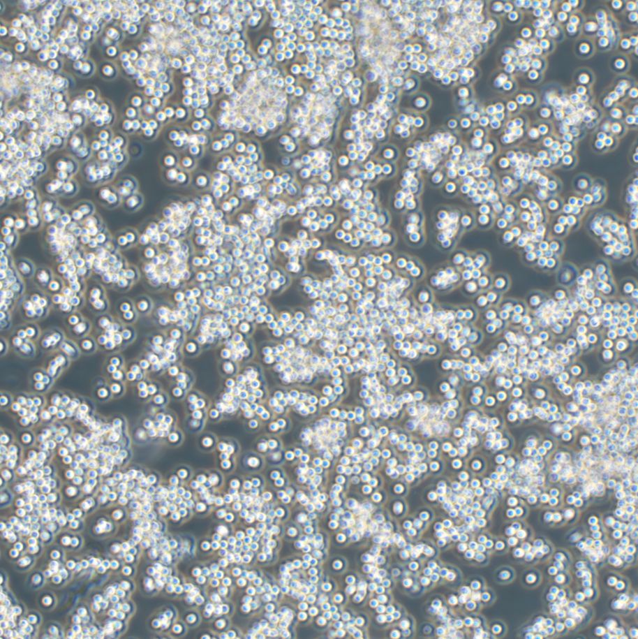 FTC-133人甲状腺癌细胞（附STR鉴定报告）、FTC-133细胞