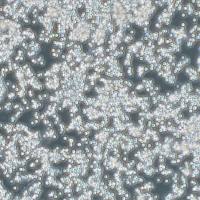 FTC-133人甲状腺癌细胞(附STR鉴定报告)、FTC-133细胞