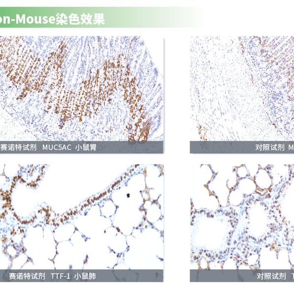 鼠抗鼠Mouse-on-Mouse免疫显色试剂盒CSK2003