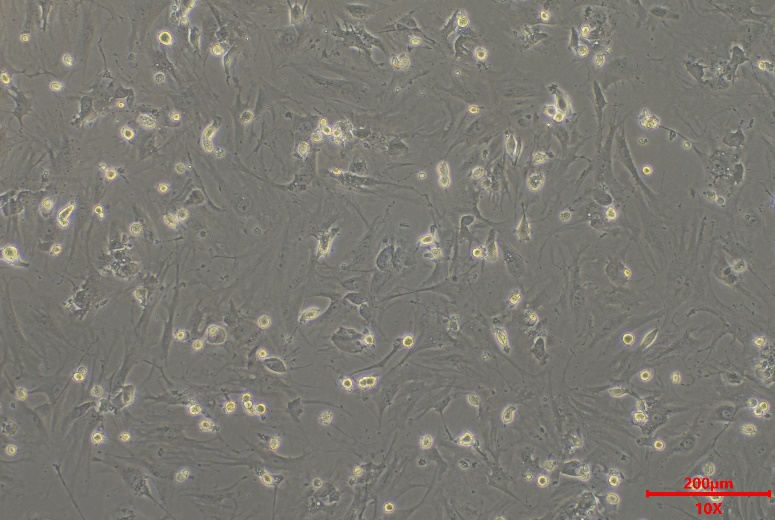 肝纤维化的“幕后黑手”竟是它?收服这只“捣蛋鬼”,你的实验稳了!(图3) 肝纤维化的“幕后黑手”竟是它?收服这只“捣蛋鬼”,你的实验稳了!(图3)