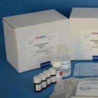 土壤（Soil）氨单加氧酶（AMO） ELISA检测试剂盒