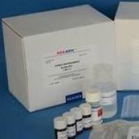 人（Human）基质金属蛋白酶2（MMP-2） ELISA检测试剂盒