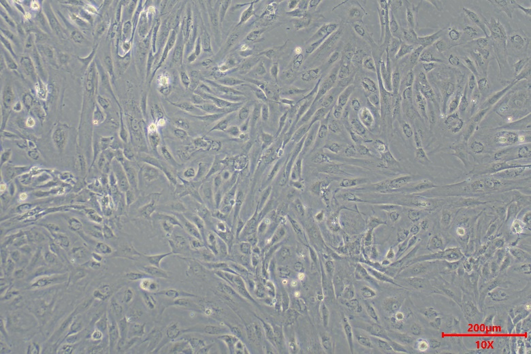 肝纤维化的“幕后黑手”竟是它?收服这只“捣蛋鬼”,你的实验稳了!(图4)