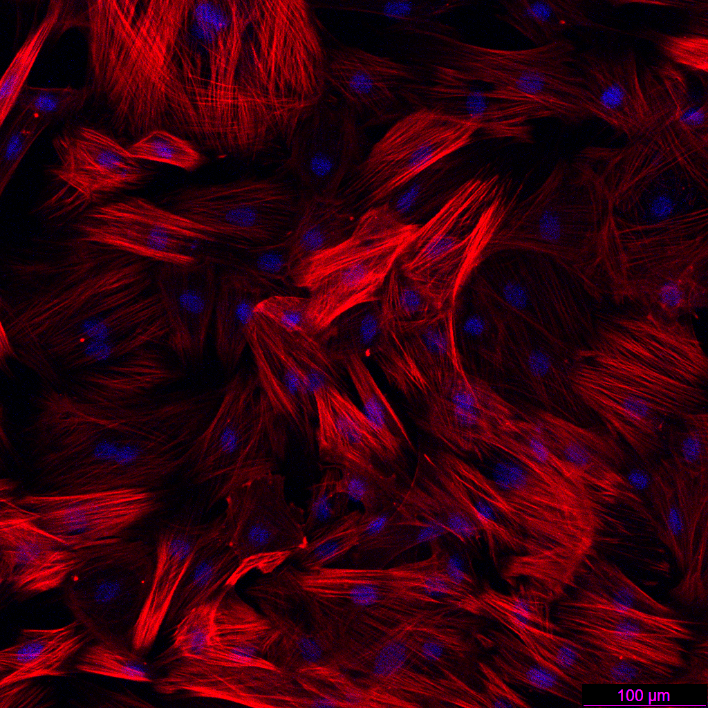 肝纤维化的“幕后黑手”竟是它?收服这只“捣蛋鬼”,你的实验稳了!(图6)