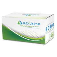 EliKine™ 人T细胞免疫球蛋白域粘蛋白域蛋白-1 ELISA定量试剂盒