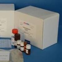 人（Human）细胞角蛋白13（CK-13）ELISA检测试剂盒