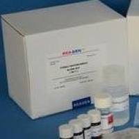 人（Human）心脏特异性丝氨酸蛋白酶（CORIN） ELISA检测试剂盒