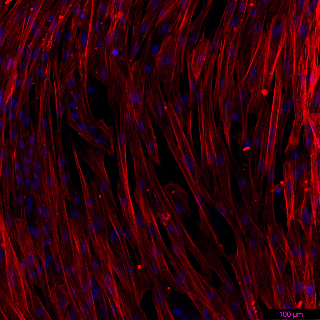 肝纤维化的“幕后黑手”竟是它?收服这只“捣蛋鬼”,你的实验稳了!(图8)