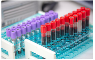 从细胞培养上清到脑脊液：ELISA 特殊样本处理全流程揭秘-Elabscience 