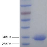 重组霍 乱毒素A亚单位蛋白