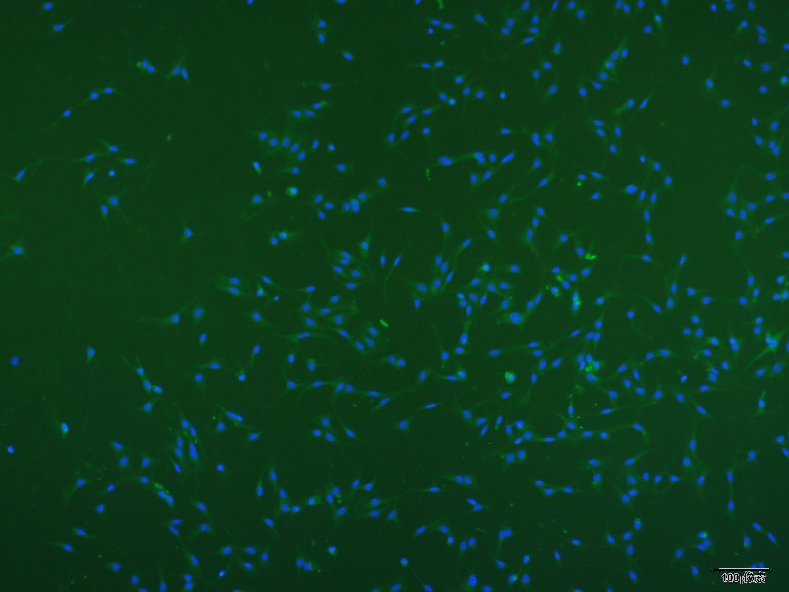 原代肝细胞系列（四）——肝窦内皮细胞（LSECs） 