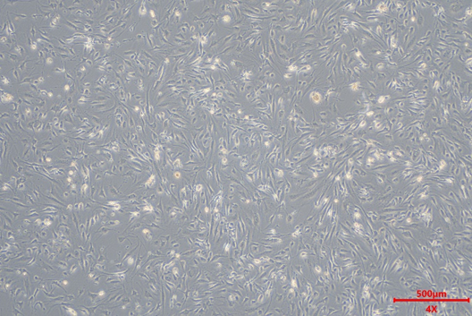 肝纤维化的“幕后黑手”竟是它?收服这只“捣蛋鬼”,你的实验稳了!(图5)