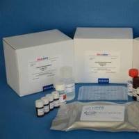 人（Human）神经丝轻链蛋白（NF-light） ELISA检测试剂盒