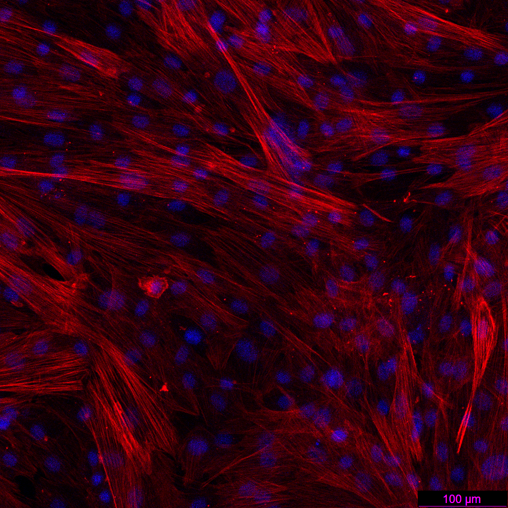 肝纤维化的“幕后黑手”竟是它?收服这只“捣蛋鬼”,你的实验稳了!(图7)