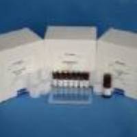 人（Human）基质金属蛋白酶抑制因子1（TIMP-1） ELISA检测试剂盒