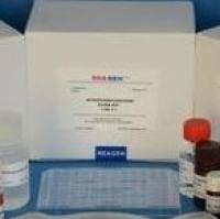 人（Human）基质金属蛋白酶抑制因子2（TIMP-2） ELISA检测试剂盒