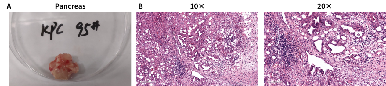 基因修饰原发肿瘤小鼠模型，为您的科研一键加速！