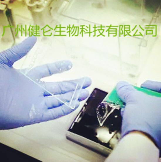 无形体IgM抗体IFA荧光玻片检测试剂盒