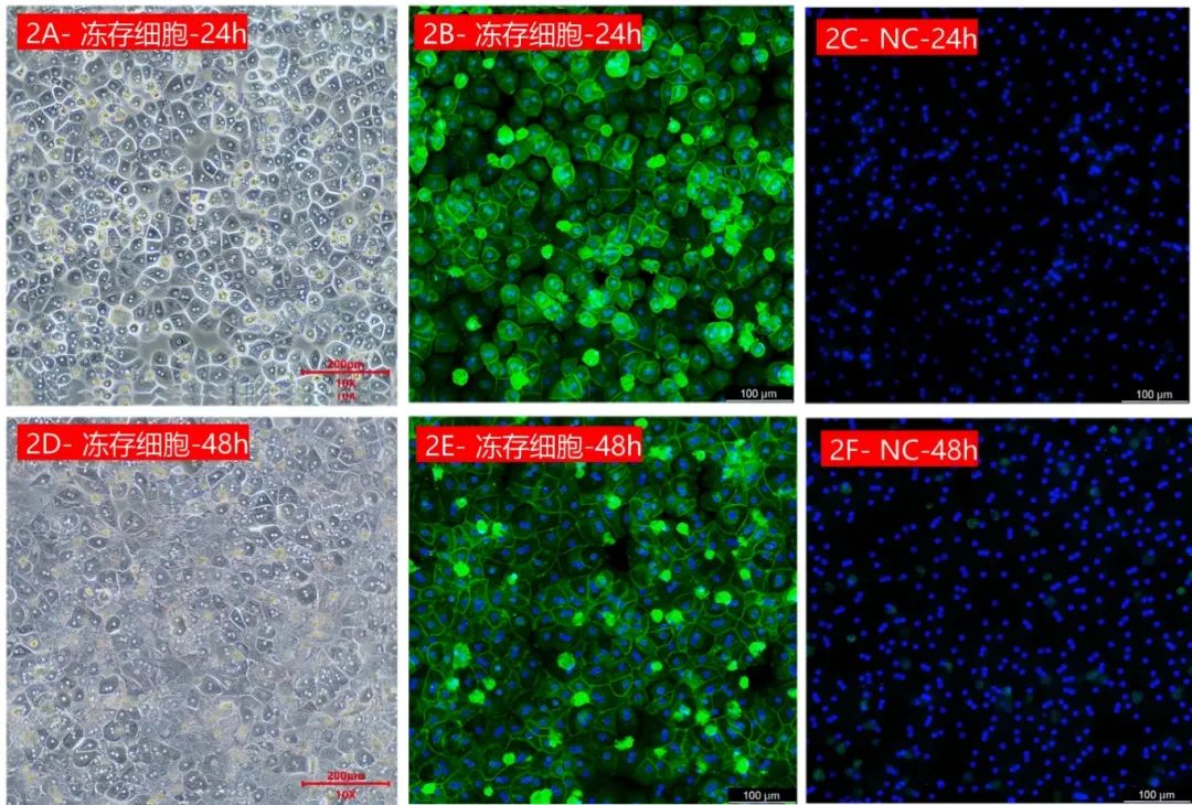 冻存VS新鲜：ASGPR受体活性曲线重叠度高达99%(图2)
