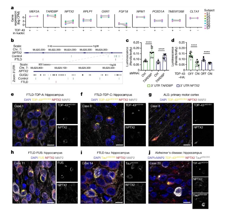 Nature | 突破!iPSC模型揭秘ALS/FTLD致病新机制,NPTX2成治疗新靶点