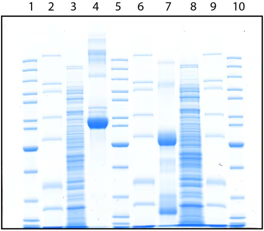 Western Blot（WB）实验原理和步骤 -赛默飞
