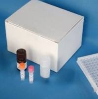 人(Human)丁型肝炎病毒IgG(HDV-IgG) ELISA检测试剂盒