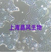 原代细胞人肠微血管内皮细胞价格