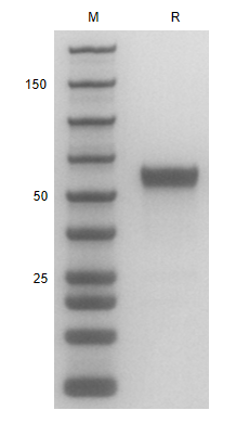 Recombinant Human CD137L /His