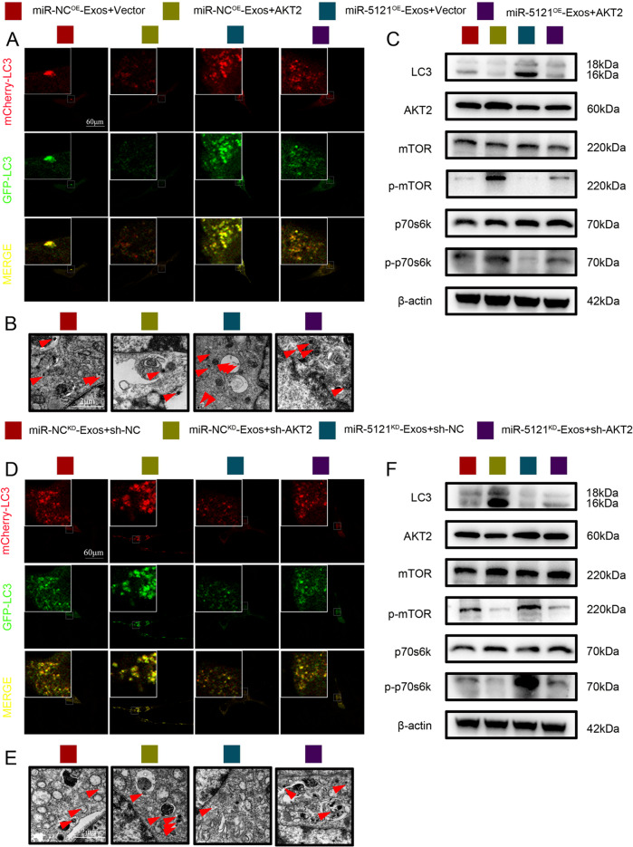 细胞自噬 细胞自噬