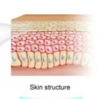 壳聚糖水凝胶包裹噻吗洛尔 CS hydrogel@Timolol