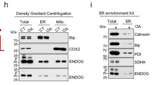 一文掌握内质网应激信号通路!
