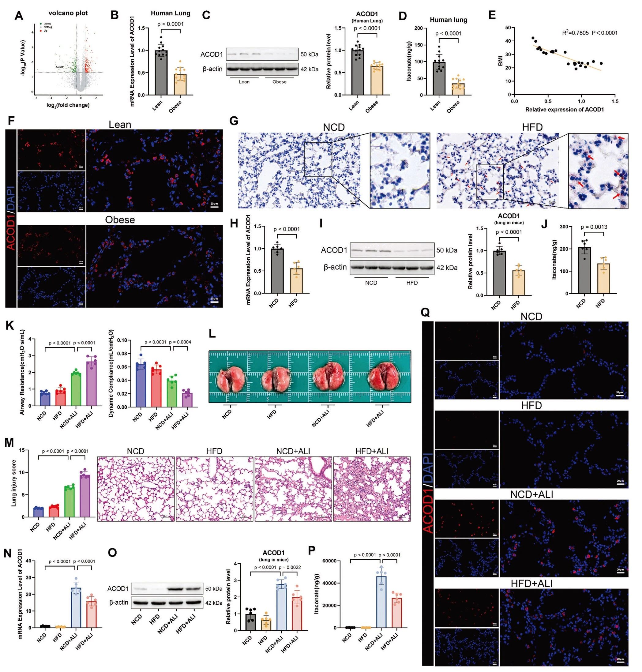 Adv Sci | 重庆医科大学魏珂研究团队揭示肥胖加重急性肺损伤的新机制